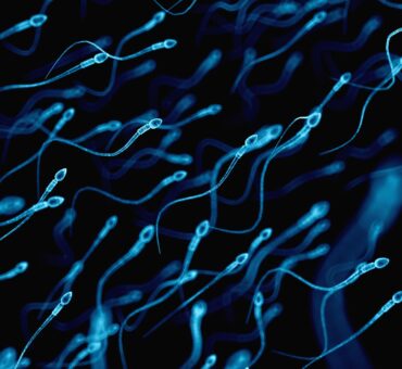 iranidawakhana-male-treatment-spermatography-semen