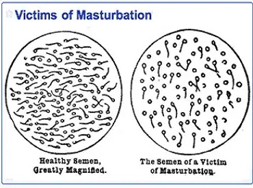 iranidawakhana-male-treatments-masturbation