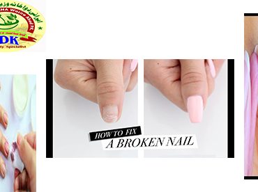 Recovery Of A Broken Nail