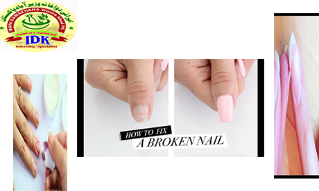Recovery Of A Broken Nail