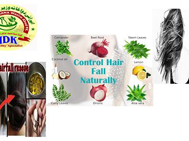 iranidawakhana-natural-tips-female-tips-remedy-for-hair-loss