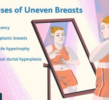 iranidawakhana-treatment-female-treatment-small-breasts-causes-of-small-breasts