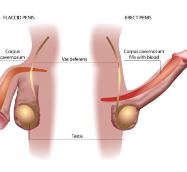 iranidawakhana-treatment-male-treatment-causes-of-small-penis