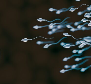 iranidawakhana-treatment-male-treatment-spermatography-sperms